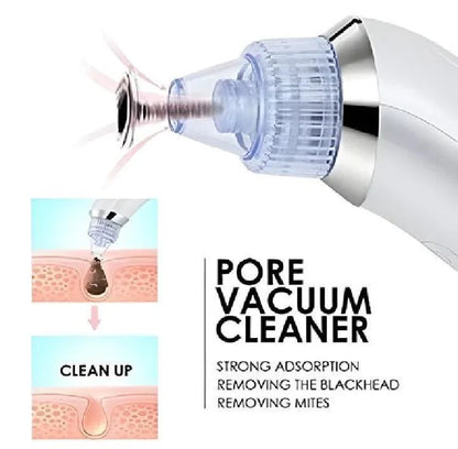 Derma Suction Facial Cleanser – Electric Pore Cleaner for Sensitive Skin, Dead Skin & Blackhead Removal, Gentle ABS Suction Device - JSJunoon.com