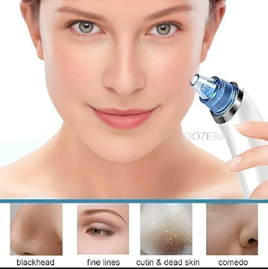 Derma Suction Facial Cleanser – Electric Pore Cleaner for Sensitive Skin, Dead Skin & Blackhead Removal, Gentle ABS Suction Device