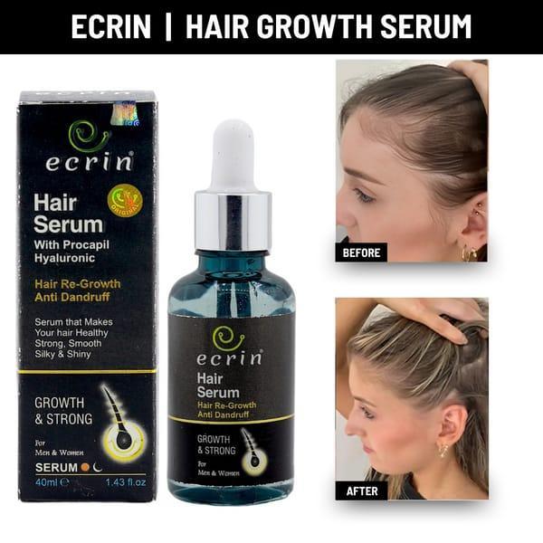 Hair Growth Serum, 40ml – Promotes Hair Regrowth, Strengthens Roots, Fights Dandruff, Adds Shine & Smoothness with Essential Oils