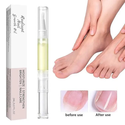 Nail Growth Treatment Serum | Nail Fungus Care & Strengthening Formula | 1 Pc - JSJunoon.com